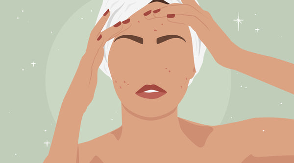 Beauty 101: Every Type of Acne, Explained