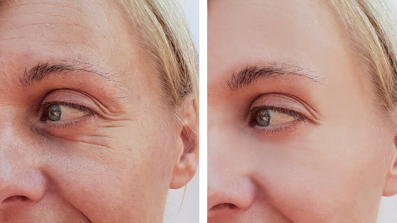 BEAUTY TIPS TO SLOW DOWN AGEING PROCESS